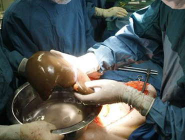 best nephrologist in kolkata