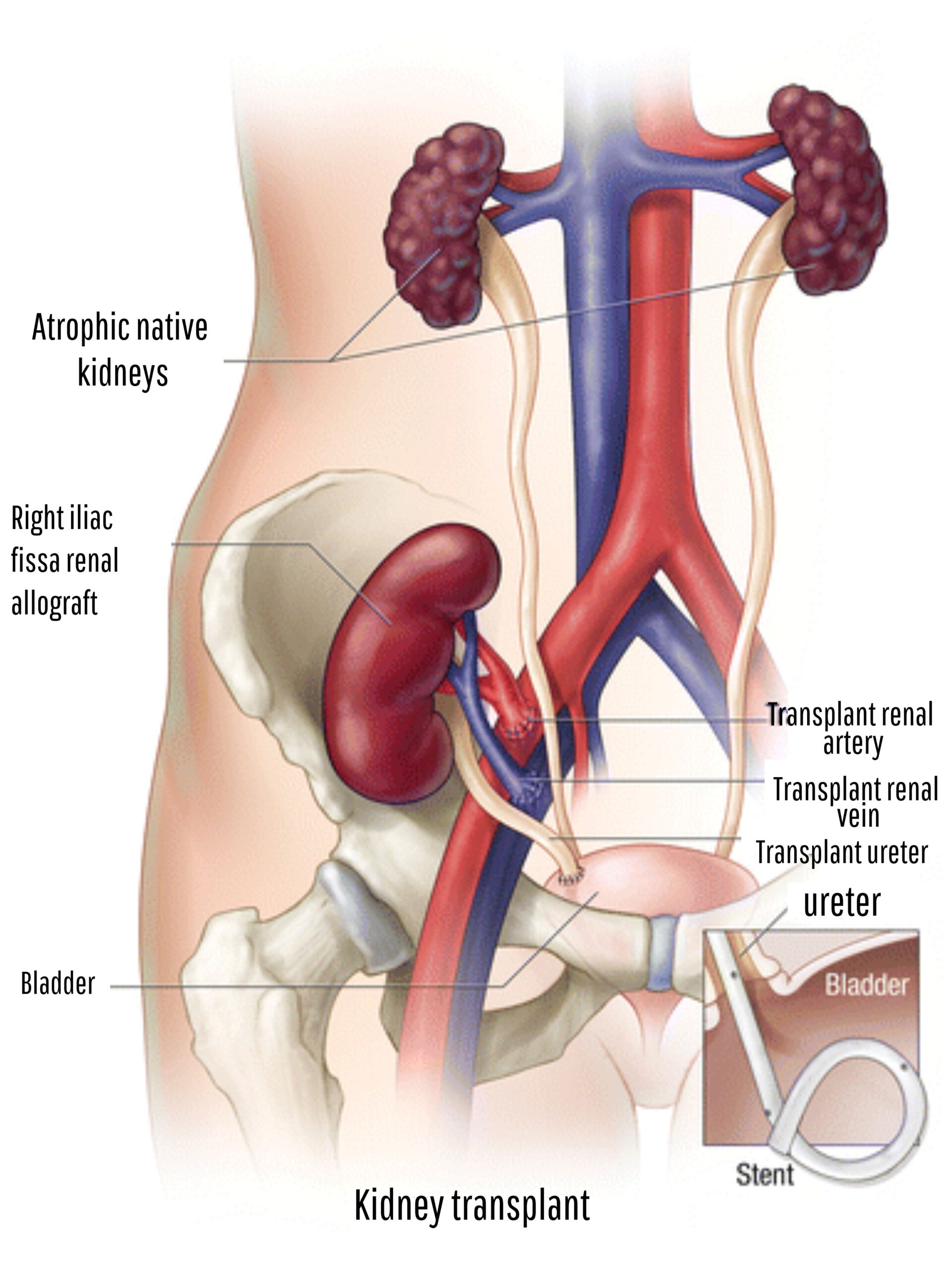 Renal transplant physician